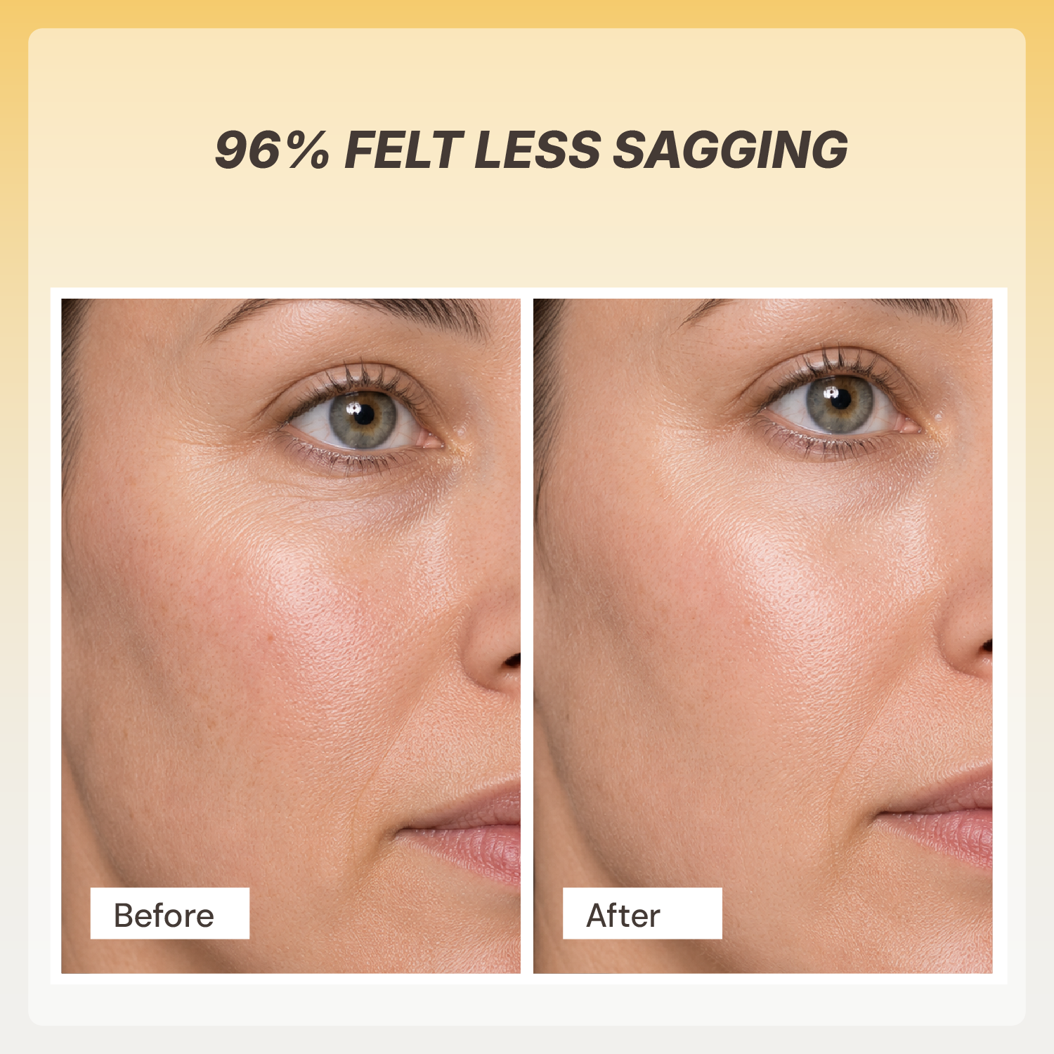 Retinol Renewal Cream
