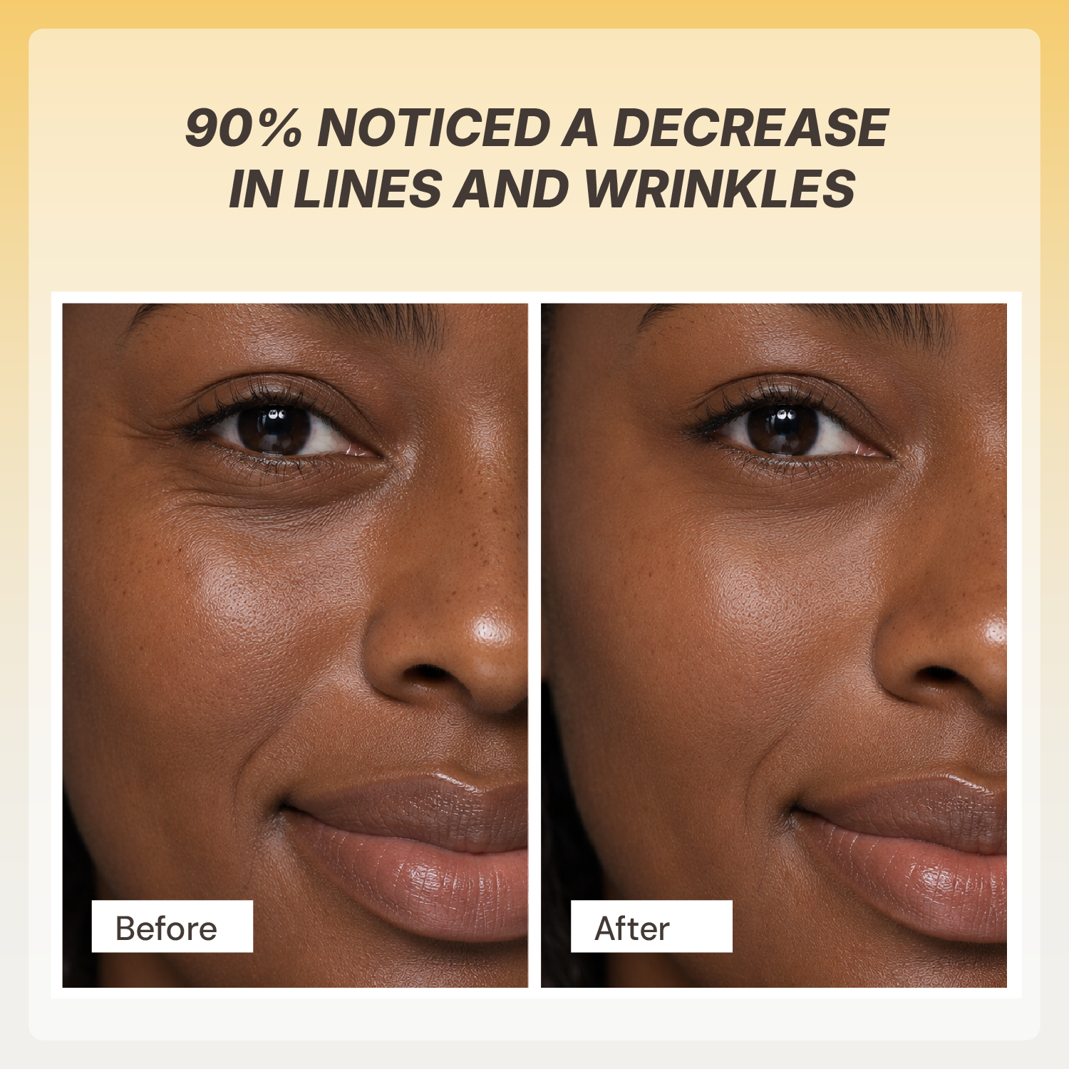 Retinol Renewal Serum